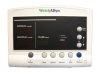 Welch Allyn 52000 Series Vital Signs Monitor – With Stand Welch Allyn 52000 Series Vital Signs Monitor – With Stand